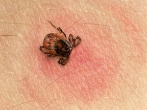 La maladie de Lyme : causes, symptomes et traitement